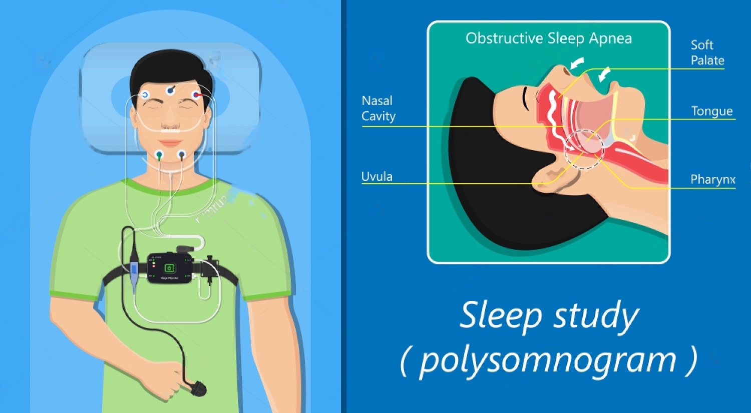 polysomnography